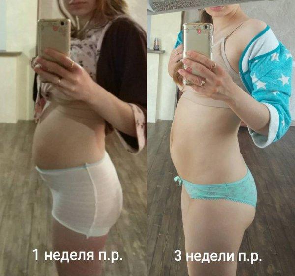 Как выглядит живот после родов